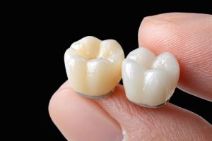 Dental Crowns Closeup of two dental crowns held by finger 3d medical object icon for healthcare and clinical use